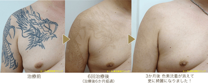 ピコレーザーラボ 美容外科 皮膚科 婦人科形成のルーチェクリニック